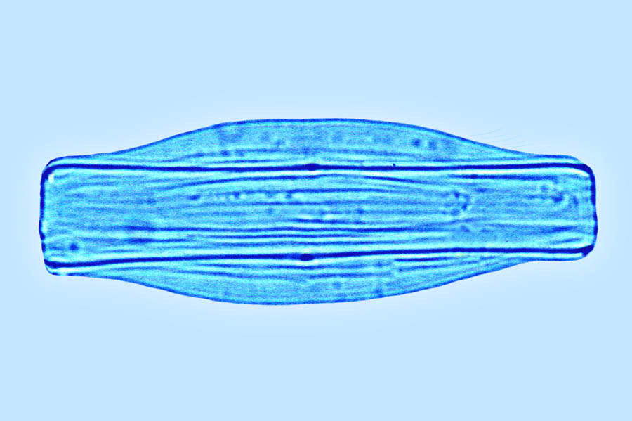 Amcadifa Amphora cymbelloides